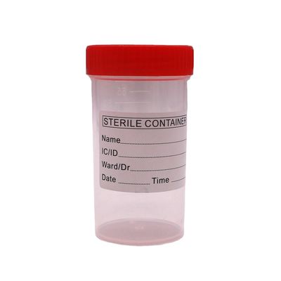 50 ml/60 ml PP πλαστικό φλιτζάνι συλλογής κοπράνων για φιάλη δειγμάτων σε εργαστηριακά είδη